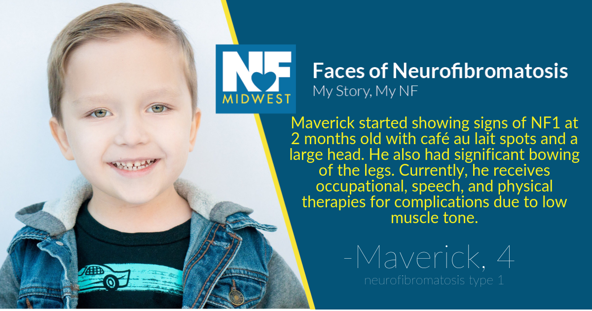 Maverick - A Face of NF - Neurofibromatosis Midwest